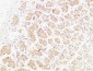 TNF-α Polyclonal Antibody